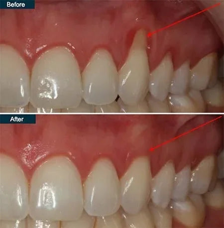 Gum Protect Gel