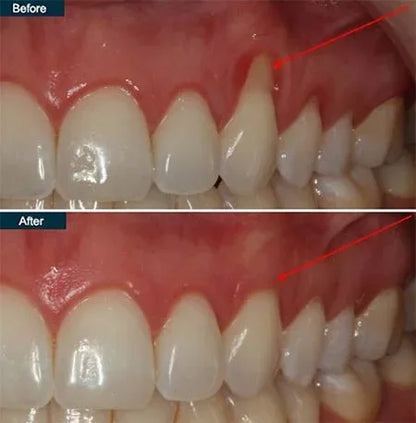 Gum Protect Gel
