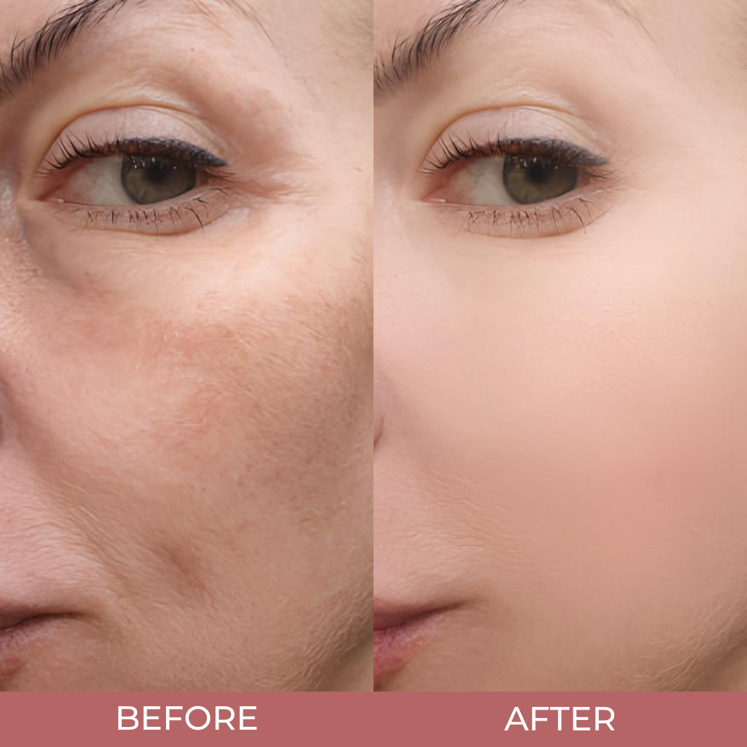 Glow Rice Ampoule Duo
